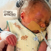 Aussie Pals Premature/NICU Babywear (Patent-Pending)
