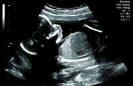 A Tiny Miracle: How Your Baby Grows in the Womb - Duper DuDu